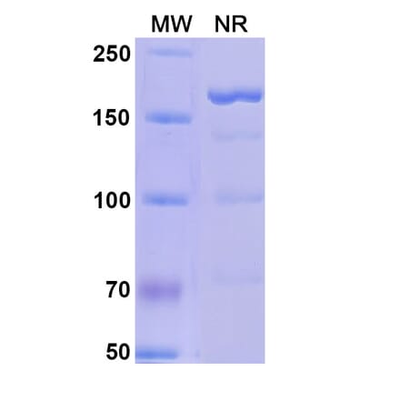 SDS-PAGE - Alefacept Biosimilar - Anti-CD2 Antibody - BSA and Azide free (A339598) - Antibodies.com