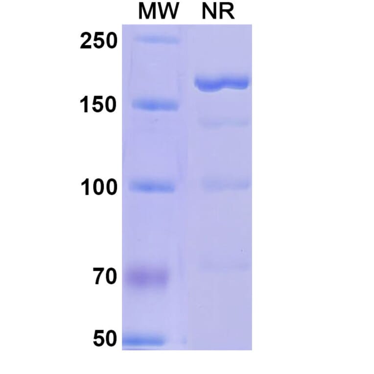 SDS-PAGE - Alefacept Biosimilar - Anti-CD2 Antibody - BSA and Azide free (A339598) - Antibodies.com