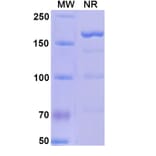 SDS-PAGE - Alefacept Biosimilar - Anti-CD2 Antibody - BSA and Azide free (A339598) - Antibodies.com