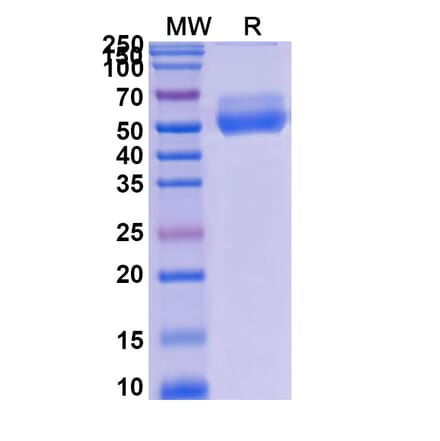 SDS-PAGE - Asunercept Biosimilar - Anti-Fas Ligand Antibody - BSA and Azide free (A339599) - Antibodies.com