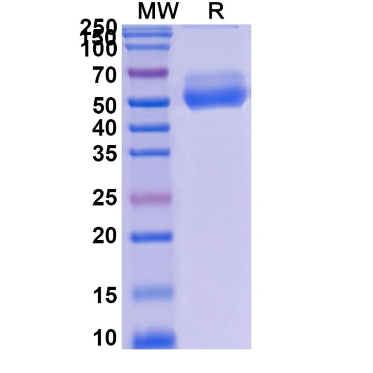 SDS-PAGE - Asunercept Biosimilar - Anti-Fas Ligand Antibody - BSA and Azide free (A339599) - Antibodies.com