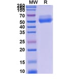 SDS-PAGE - Asunercept Biosimilar - Anti-Fas Ligand Antibody - BSA and Azide free (A339599) - Antibodies.com
