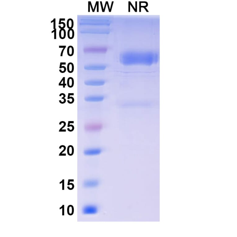 SDS-PAGE - Baminercept Alfa Biosimilar - Anti-TNF beta + Lymphotoxin beta + LIGHT Antibody - BSA and Azide free (A339601) - Antibodies.com