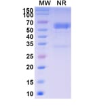SDS-PAGE - Baminercept Alfa Biosimilar - Anti-TNF beta + Lymphotoxin beta + LIGHT Antibody - BSA and Azide free (A339601) - Antibodies.com