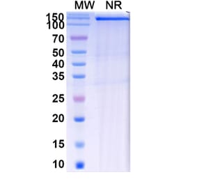 SDS-PAGE - Batiraxcept Biosimilar - Anti-GAS6 Antibody - BSA and Azide free (A339602) - Antibodies.com