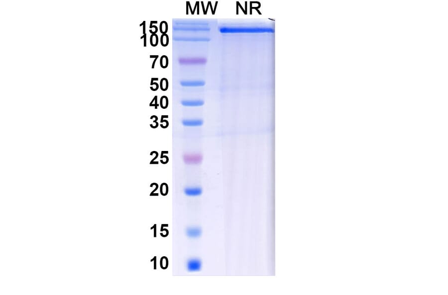 SDS-PAGE - Batiraxcept Biosimilar - Anti-GAS6 Antibody - BSA and Azide free (A339602) - Antibodies.com