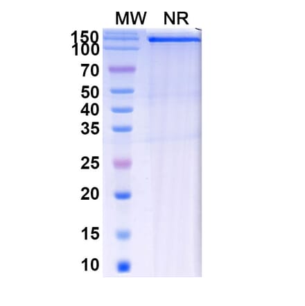 SDS-PAGE - Batiraxcept Biosimilar - Anti-GAS6 Antibody - BSA and Azide free (A339602) - Antibodies.com