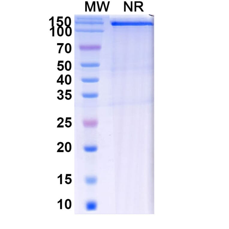 SDS-PAGE - Batiraxcept Biosimilar - Anti-GAS6 Antibody - BSA and Azide free (A339602) - Antibodies.com