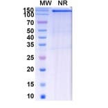 SDS-PAGE - Batiraxcept Biosimilar - Anti-GAS6 Antibody - BSA and Azide free (A339602) - Antibodies.com