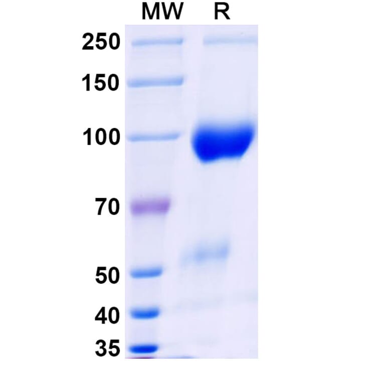 SDS-PAGE - Belatacept Biosimilar - Anti-CD80 + CD86 Antibody - BSA and Azide free (A339603) - Antibodies.com