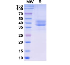 SDS-PAGE - Briobacept Biosimilar - Anti-BAFF Antibody - BSA and Azide free (A339604) - Antibodies.com