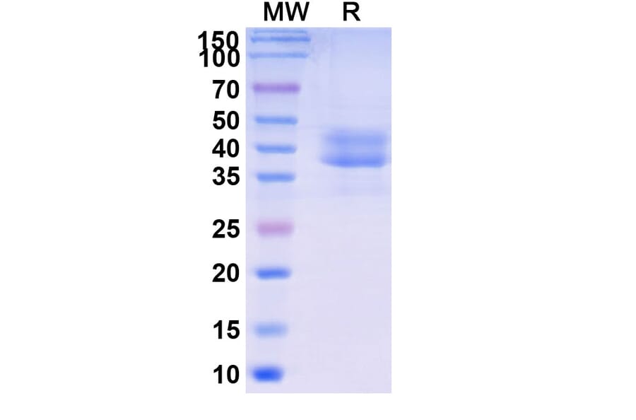 SDS-PAGE - Briobacept Biosimilar - Anti-BAFF Antibody - BSA and Azide free (A339604) - Antibodies.com