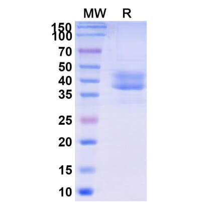 SDS-PAGE - Briobacept Biosimilar - Anti-BAFF Antibody - BSA and Azide free (A339604) - Antibodies.com