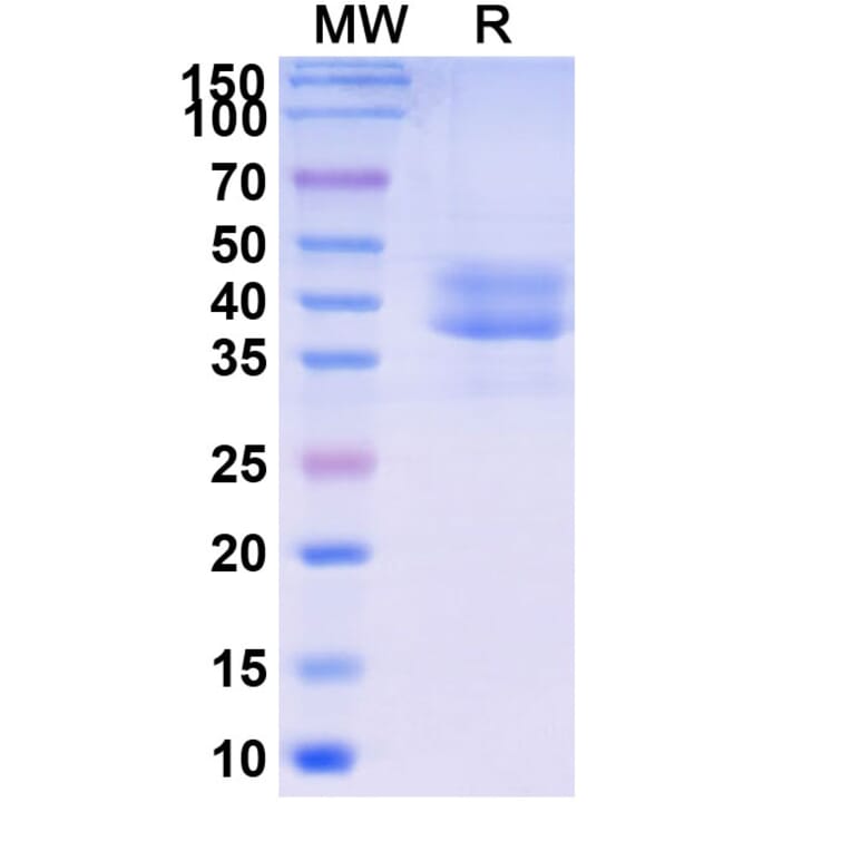 SDS-PAGE - Briobacept Biosimilar - Anti-BAFF Antibody - BSA and Azide free (A339604) - Antibodies.com