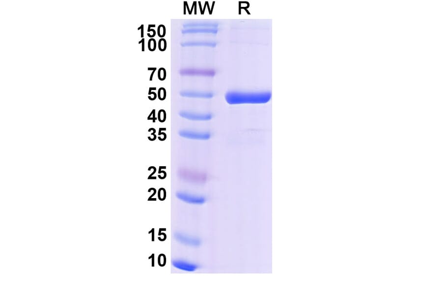 SDS-PAGE - Efgivanermin Alfa Biosimilar - Anti-GITR Antibody - BSA and Azide free (A339610) - Antibodies.com