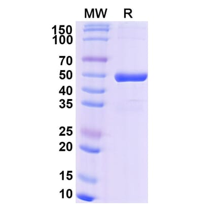 SDS-PAGE - Efgivanermin Alfa Biosimilar - Anti-GITR Antibody - BSA and Azide free (A339610) - Antibodies.com