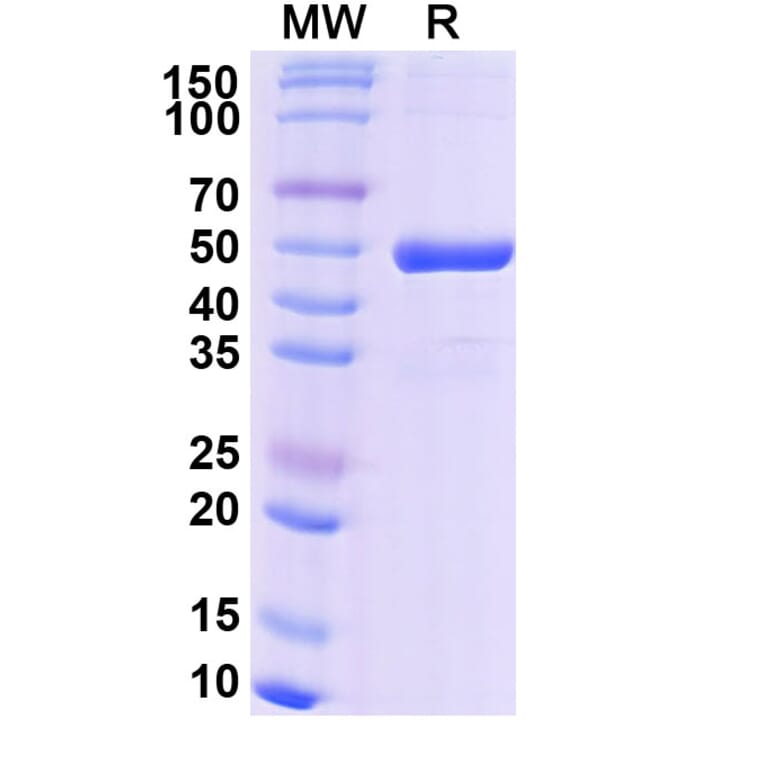 SDS-PAGE - Efgivanermin Alfa Biosimilar - Anti-GITR Antibody - BSA and Azide free (A339610) - Antibodies.com