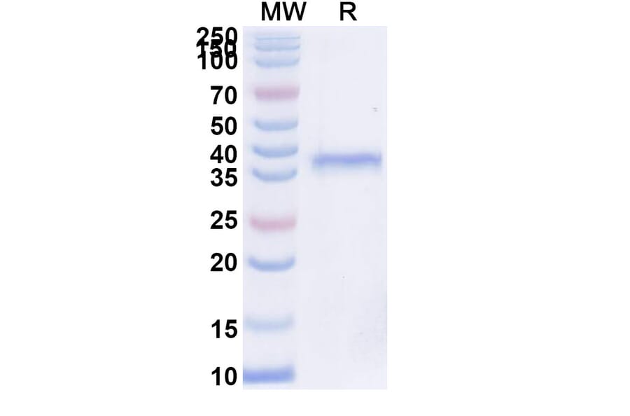 SDS-PAGE - Inbakicept Biosimilar - Anti-IL-15 Antibody - BSA and Azide free (A339613) - Antibodies.com