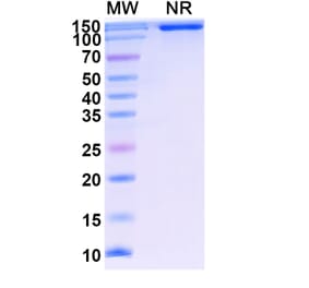 SDS-PAGE - Lenercept Biosimilar - Anti-TNF alpha Antibody - BSA and Azide free (A339615) - Antibodies.com