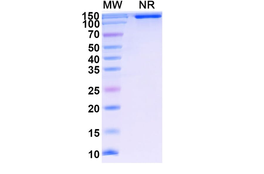 SDS-PAGE - Lenercept Biosimilar - Anti-TNF alpha Antibody - BSA and Azide free (A339615) - Antibodies.com