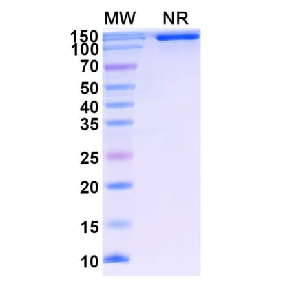 SDS-PAGE - Lenercept Biosimilar - Anti-TNF alpha Antibody - BSA and Azide free (A339615) - Antibodies.com