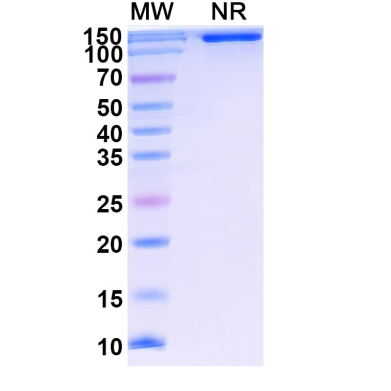 SDS-PAGE - Lenercept Biosimilar - Anti-TNF alpha Antibody - BSA and Azide free (A339615) - Antibodies.com