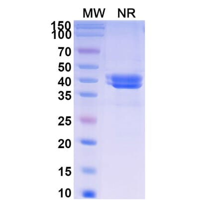 SDS-PAGE - Ontorpacept Biosimilar - Anti-CD47 Antibody - BSA and Azide free (A339617) - Antibodies.com