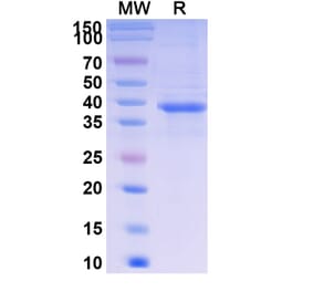 SDS-PAGE - Telitacicept Biosimilar - Anti-BAFF Antibody - BSA and Azide free (A339620) - Antibodies.com