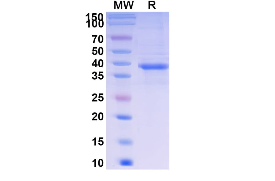 SDS-PAGE - Telitacicept Biosimilar - Anti-BAFF Antibody - BSA and Azide free (A339620) - Antibodies.com