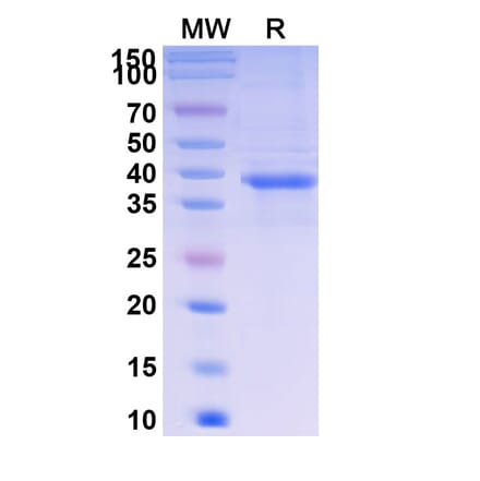 SDS-PAGE - Telitacicept Biosimilar - Anti-BAFF Antibody - BSA and Azide free (A339620) - Antibodies.com