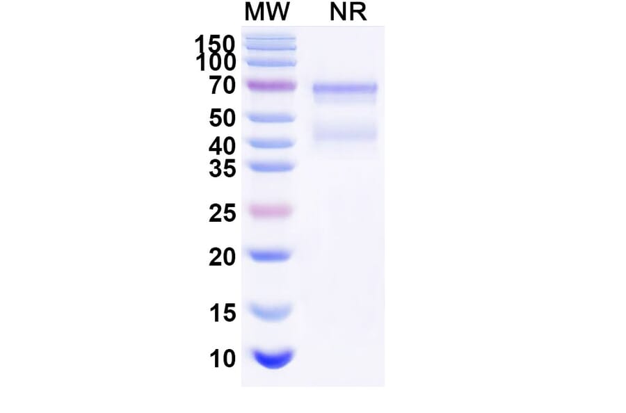 SDS-PAGE - Tulinercept Biosimilar - Anti-TNF alpha Antibody - BSA and Azide free (A339621) - Antibodies.com