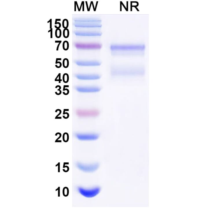 SDS-PAGE - Tulinercept Biosimilar - Anti-TNF alpha Antibody - BSA and Azide free (A339621) - Antibodies.com