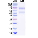 SDS-PAGE - Tulinercept Biosimilar - Anti-TNF alpha Antibody - BSA and Azide free (A339621) - Antibodies.com