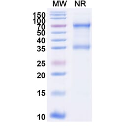 SDS-PAGE - Tenecteplase Biosimilar - Anti-tPA Antibody - BSA and Azide free (A339622) - Antibodies.com