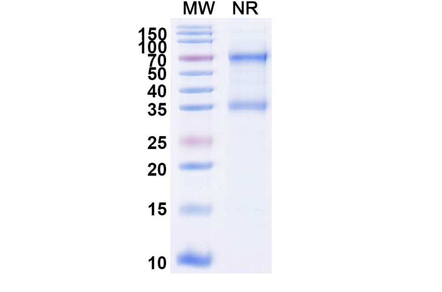 SDS-PAGE - Tenecteplase Biosimilar - Anti-tPA Antibody - BSA and Azide free (A339622) - Antibodies.com