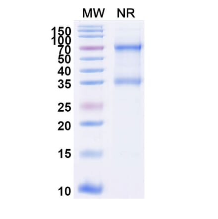 SDS-PAGE - Tenecteplase Biosimilar - Anti-tPA Antibody - BSA and Azide free (A339622) - Antibodies.com