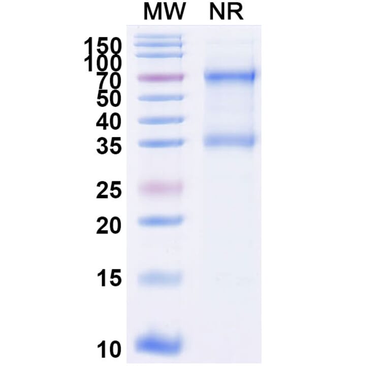 SDS-PAGE - Tenecteplase Biosimilar - Anti-tPA Antibody - BSA and Azide free (A339622) - Antibodies.com