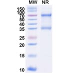 SDS-PAGE - Tenecteplase Biosimilar - Anti-tPA Antibody - BSA and Azide free (A339622) - Antibodies.com