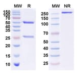 SDS-PAGE - Anti-IL3RB Antibody [CSL 311] Biosimilar - BSA and Azide free (A339629) - Antibodies.com