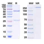 SDS-PAGE - Anti-CTLA-4 Antibody [ADG 116] Biosimilar - BSA and Azide free (A339630) - Antibodies.com