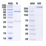 SDS-PAGE - Anti-CTLA-4 Antibody [BMS-986218] Biosimilar - BSA and Azide free (A339635) - Antibodies.com
