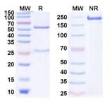 SDS-PAGE - Anti-CTLA-4 Antibody [XTX11] Biosimilar - BSA and Azide free (A339642) - Antibodies.com