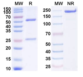 SDS-PAGE - Anti-CXCR4 Antibody [CF172] Biosimilar - BSA and Azide free (A339648) - Antibodies.com