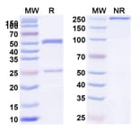 SDS-PAGE - Anti-CXCR5 Antibody [BAY-924] Biosimilar - BSA and Azide free (A339652) - Antibodies.com
