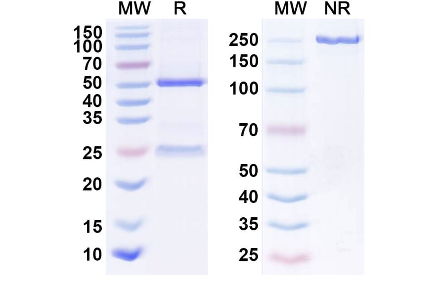 SDS-PAGE - Anti-EGFR Antibody [ABP 494] Biosimilar - BSA and Azide free (A339666) - Antibodies.com