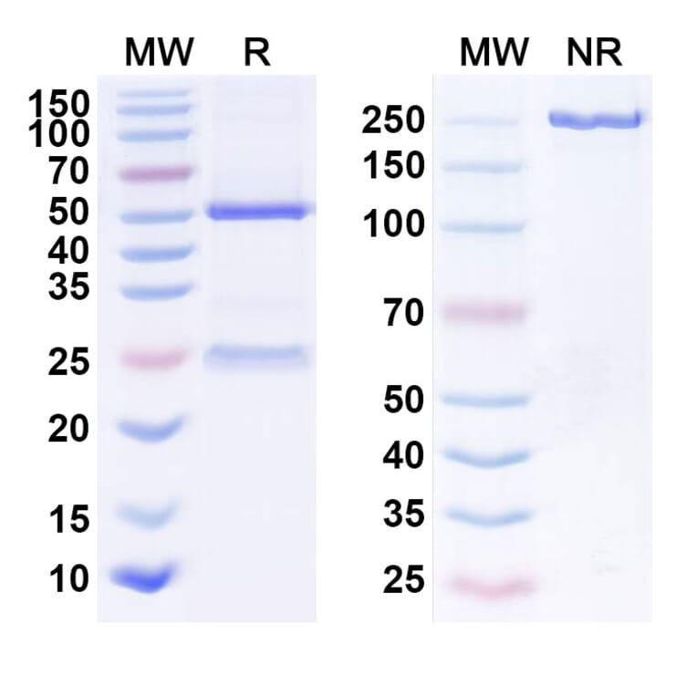 SDS-PAGE - Anti-EGFR Antibody [ABP 494] Biosimilar - BSA and Azide free (A339666) - Antibodies.com