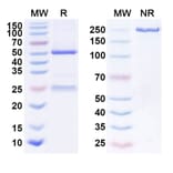 SDS-PAGE - Anti-EGFR Antibody [ABP 494] Biosimilar - BSA and Azide free (A339666) - Antibodies.com