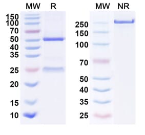SDS-PAGE - Anti-EGFR Antibody [GC1118A] Biosimilar - BSA and Azide free (A339671) - Antibodies.com