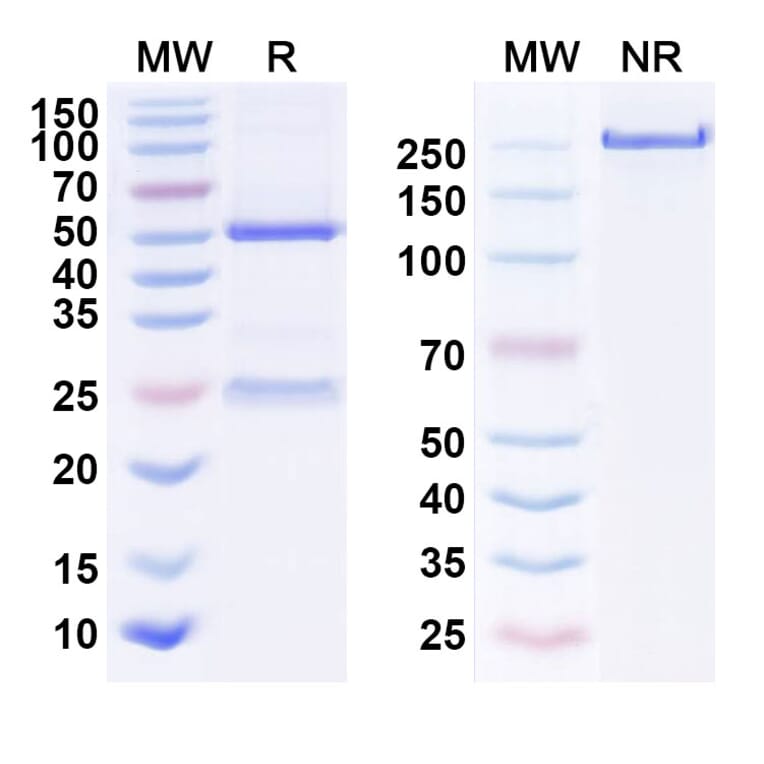 SDS-PAGE - Anti-EGFR Antibody [GC1118A] Biosimilar - BSA and Azide free (A339671) - Antibodies.com