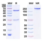 SDS-PAGE - Anti-EGFR Antibody [KT112] Biosimilar - BSA and Azide free (A339674) - Antibodies.com